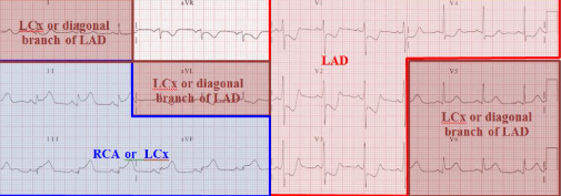 ECG-coronary-circulation.png